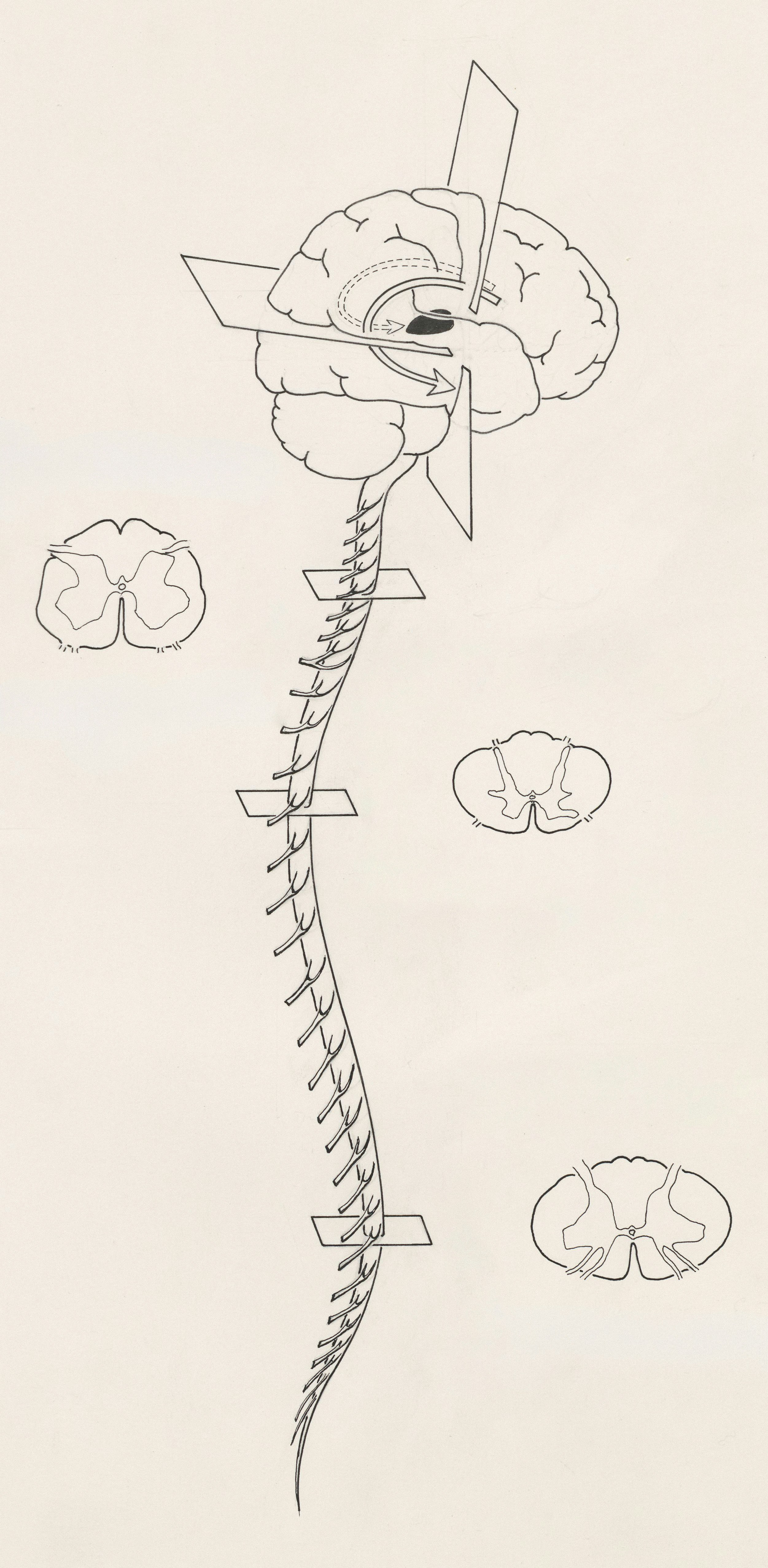 Nervous System Dysregulation: Why You Feel Stuck in Stress, Anxiety, or Exhaustion